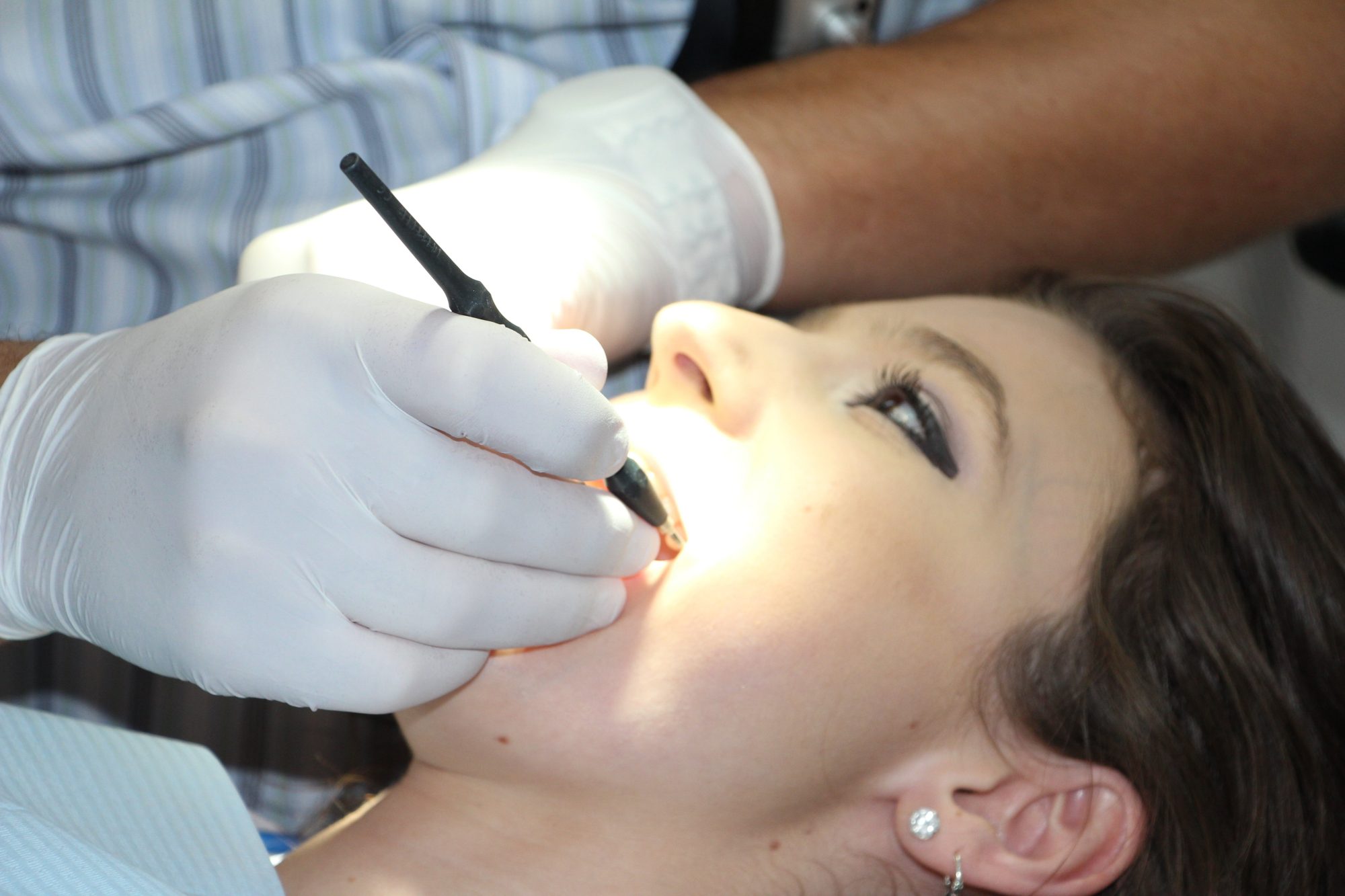 Dental Clinics in Nairobi-Teeth Cleaning